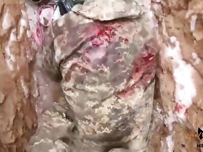 Life in Ukrop Trenches 