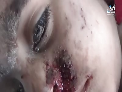 HORRIBLE Toddler Casualties Today in Tal Afar City Iraq