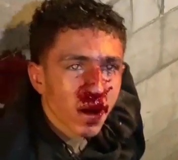 Thief savegly punished for trying to steal phone