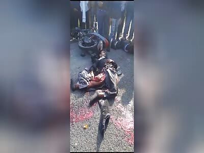 Dude Got His Legs Crushed