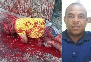 Machete Attack Leaves Dude Fucked Up Beyond Recognition 