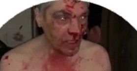 Old man horrifically abused and got his fingers hammered 