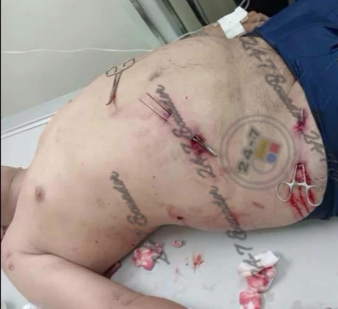 Fat gangster executed by sicario 