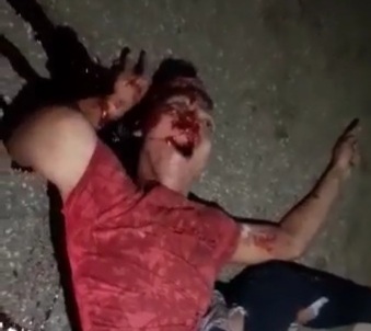 [HORRIFIC] LAST GASPS OF AIR AFTER HORRIFIC MOTORCYCLE CRASH 