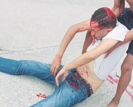 Transporting victim of motorcycle accident to hospital 