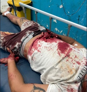 fireworks accident in Indonesia