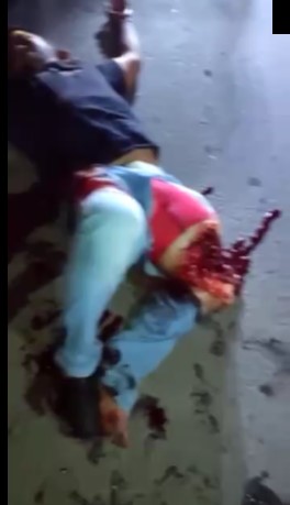 man has a horrible leg injury