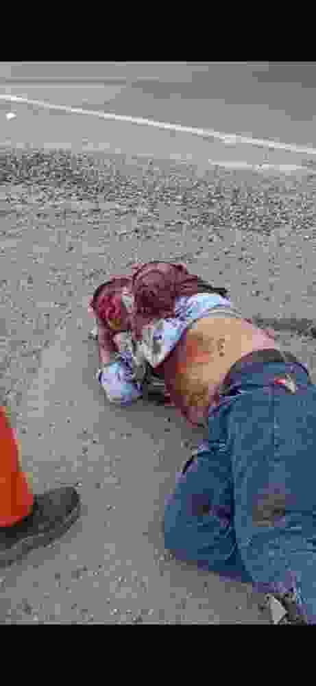 Someone Lost Their Hand