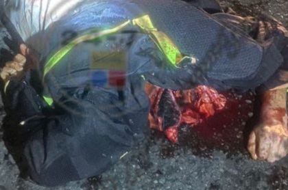 [BRAIN ON THE ASPHALT]MOTORCYCLIST HEAD CRASHED BY TRUCK 