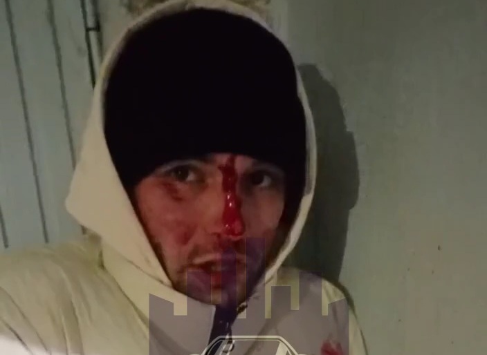 Russian man punished hard for not paying his debts 