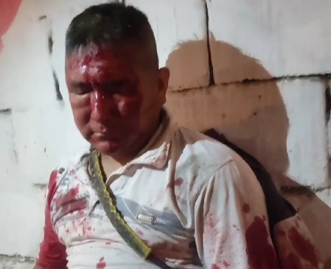 Horrific accident between motorcycle and taxi happened in Colombia 