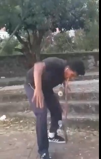 skateboarder breaks his teeth