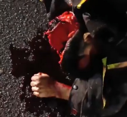 [CRACKED SKULL]MOTORCYCLIST CRASHED DEAD BY BIG TRUCK 