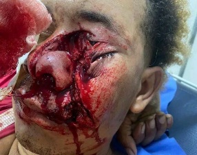 Colombian man gored by bull