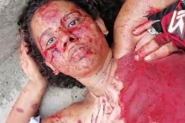 Young woman Shot by Sicario 