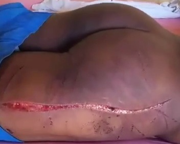 Haitian showing signs of torture after being released by kidnappers 