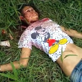 Woman Involved In Gang Dispute Pays The Price.