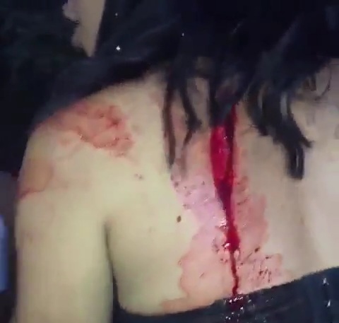 Man Attacks his ex-girlfriend with Machete 