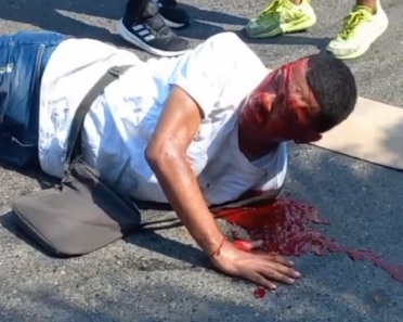 Motorcyclist crashed card by out of control car 