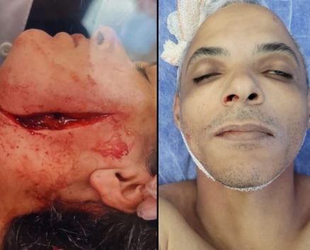 Slashes Ex-wife Face and Stabs her New Husband to Death (Action & Aftermath)