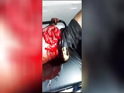 Your insides torn apart for the knife attack