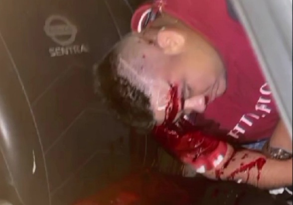 Drug dealer in his car executed by sicario 