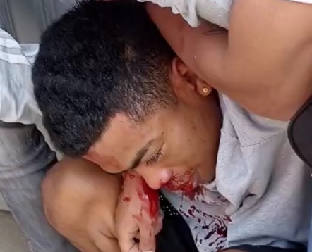 Thief captured and punished hard for stealing two phones and a bike 