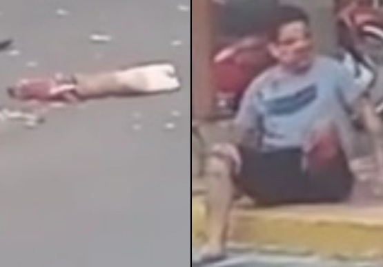 BAD DAY: Motorcycle Thief Crashes Hard Severing his Leg.