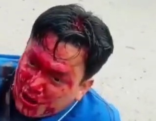 Thief punished hard for trying to steal old woman 