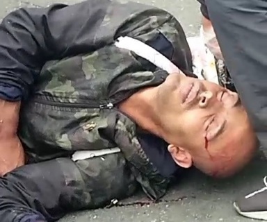 Motorcyclist crashed hard into truck 