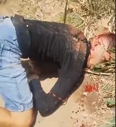 DAMN: Surviving a Gunshot to the Head