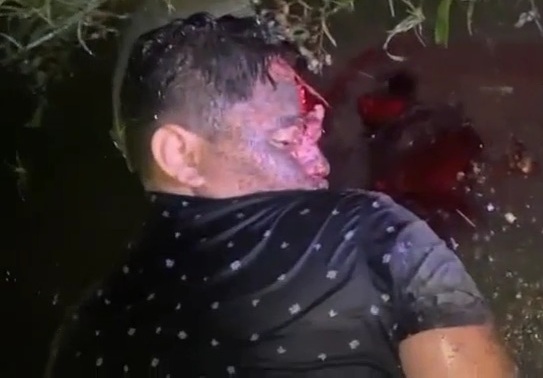 Pedestrian fatally crashed by speeding car 