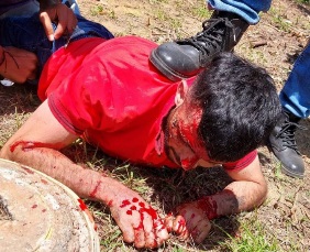 Thief captured and punished hard by angry crowds 