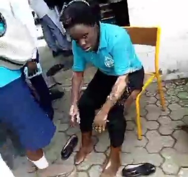 Burned schoolgirls after explosion due to gaz leak 