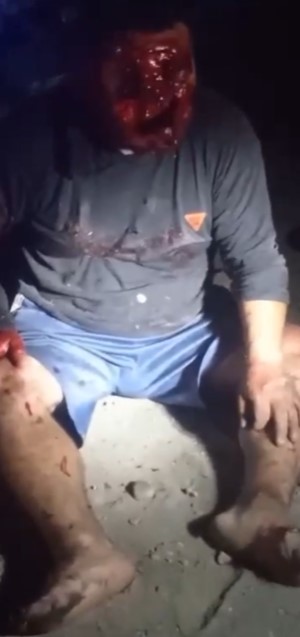 He Definitely Regrets Being Alive.