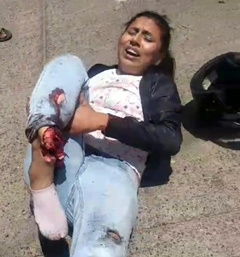 This Poor Girl is Having the Shittiest of Shitty Days.