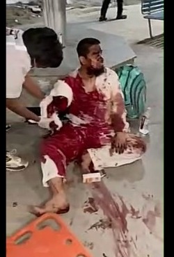 cut his arm on a train track