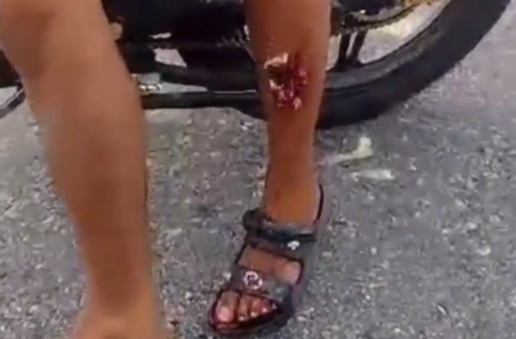  police officer shoot young woman in her leg for no reason 