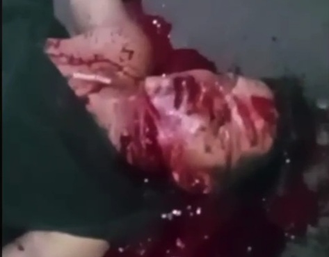 Young man victime of fatally machete attack 