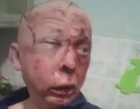 drinking session between friends ended in a beating for one of them.