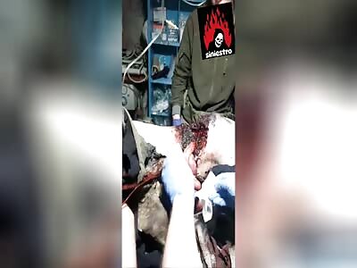 soldier had his insides destroyed by