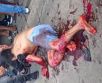 Lucky Young man survived a sicario attack 