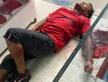 Getting shoot for not paying extortion money 