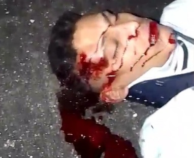 Young motorcyclist crashed hard 