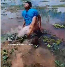 Dude Bitten by a Stingray.