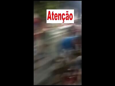 victim has serious injury to his fallen leg 2