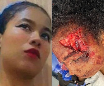 Young woman crashed dead by her motorcycle into a pole 