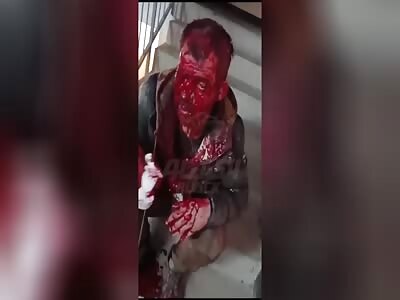 She Turns Husband's Face Into Bloody Mess Due To Suspicions Of Treason