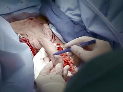 Gender Reassignment Surgery 