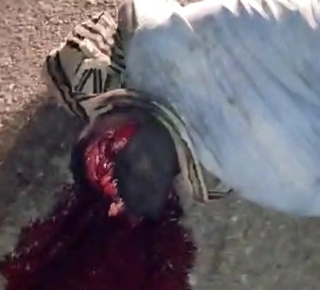 [BRAIN ON THE ASPHALT]COLOMBIAN MOTORCYCLIST CRACKED SKULL 